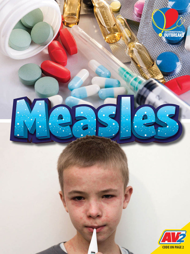 International Outbreaks: Measles